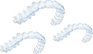 INVISALIGN-002-300x175