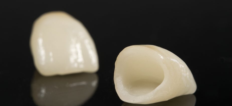 dental crowns